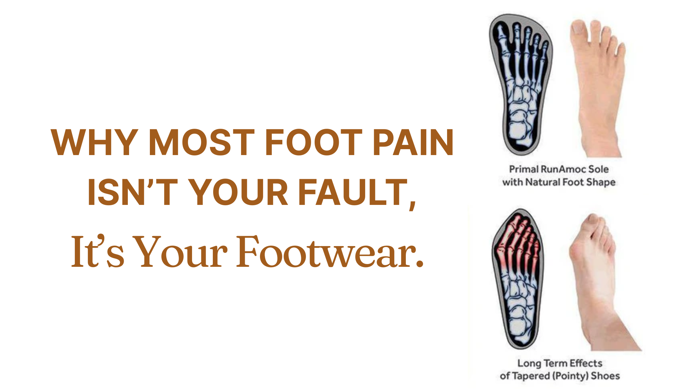Why Most Foot Pain Isn’t Your Fault — It’s Your Footwear