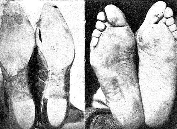 Education Sole Freedom